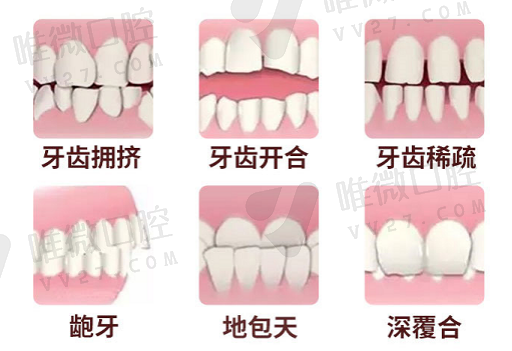 全口义齿属于缓冲区的部位是（上总义齿需要缓冲的部位）(图1)
